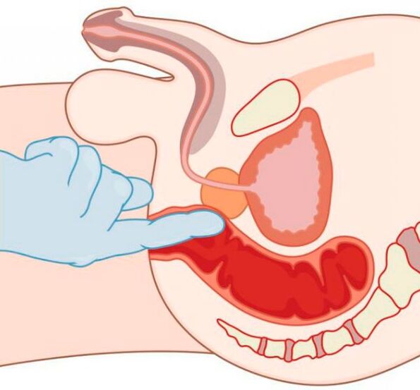 การกระตุ้น G-spot ในผู้ชายผ่านทางทวารหนัก